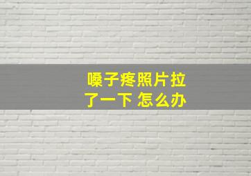 嗓子疼照片拉了一下 怎么办